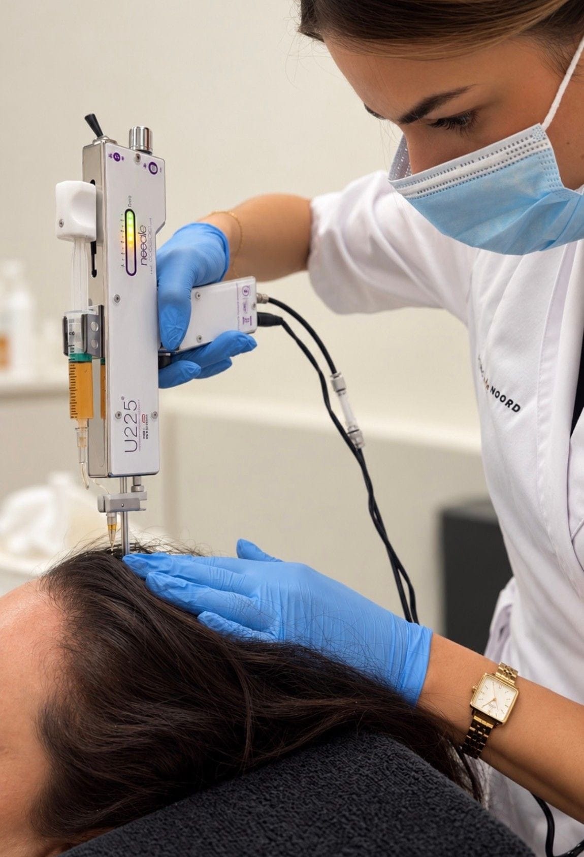 Een specialist van Clinic Noord behandelt de hoofdhuid met een injector