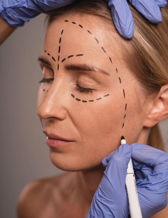 Voorbereiding botox behandeling