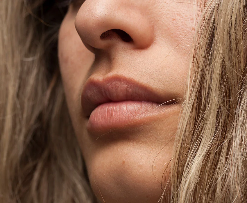 Resultaat van een lipfiller behandeling